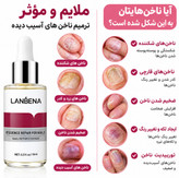 سرم تقویت کننده وترمیم کننده ضد قارچ لانبنا