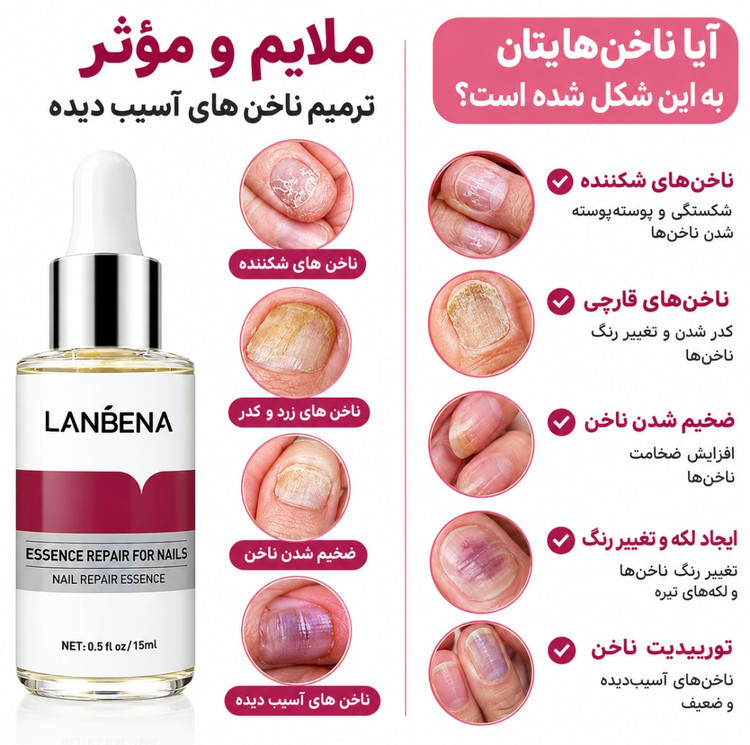 سرم تقویت کننده وترمیم کننده ضد قارچ لانبنا